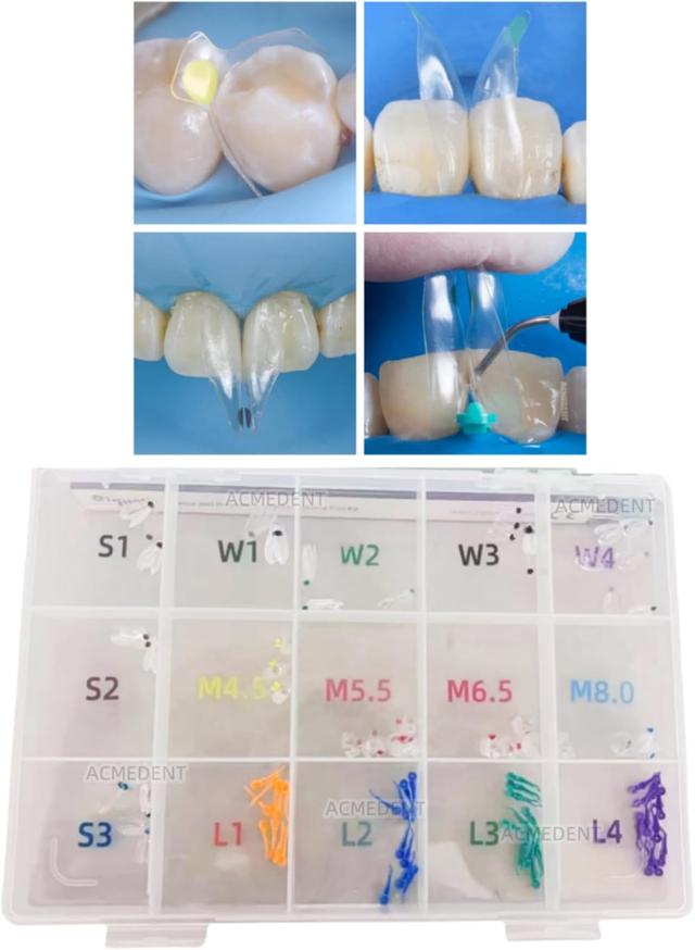 Product image of Clear Matrix Dental BT Matrices Black Triangle Wedges Diastema Transparent Sectional Matrice System